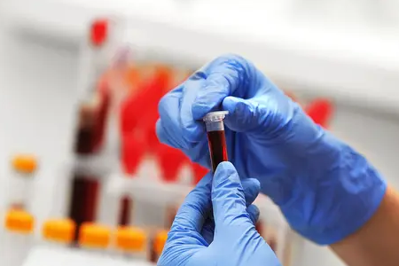 రాపిడ్ మలేరియా డిటెక్షన్: BABIO యొక్క ద్వంద్వ యాంటిజెన్ టెస్ట్ కిట్ గ్లోబల్ హెల్త్‌ను శక్తివంతం చేస్తుంది