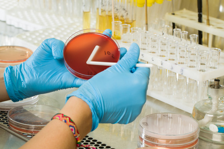 BABIO యొక్క మాక్‌కాంకీ అగర్ మీడియం - గ్లోబల్ మైక్రోబయోలాజికల్ డయాగ్నోస్టిక్స్ కోసం ప్రీమియం సెలెక్టివ్ ఐసోలేషన్